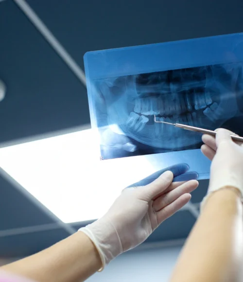 Dental-Radiology-new