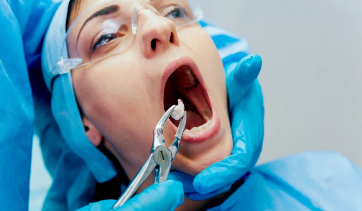 Tooth-Extraction-new