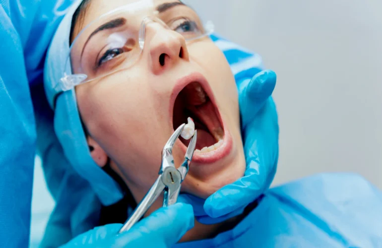Tooth-Extraction-new