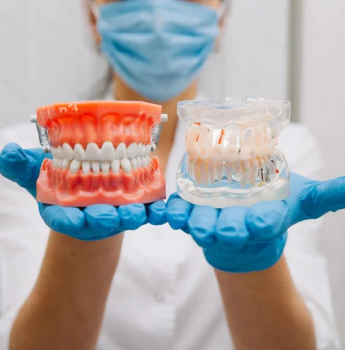 Artificial-Dentures-new