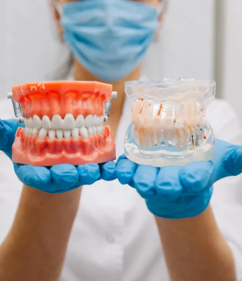 Artificial-Dentures-new