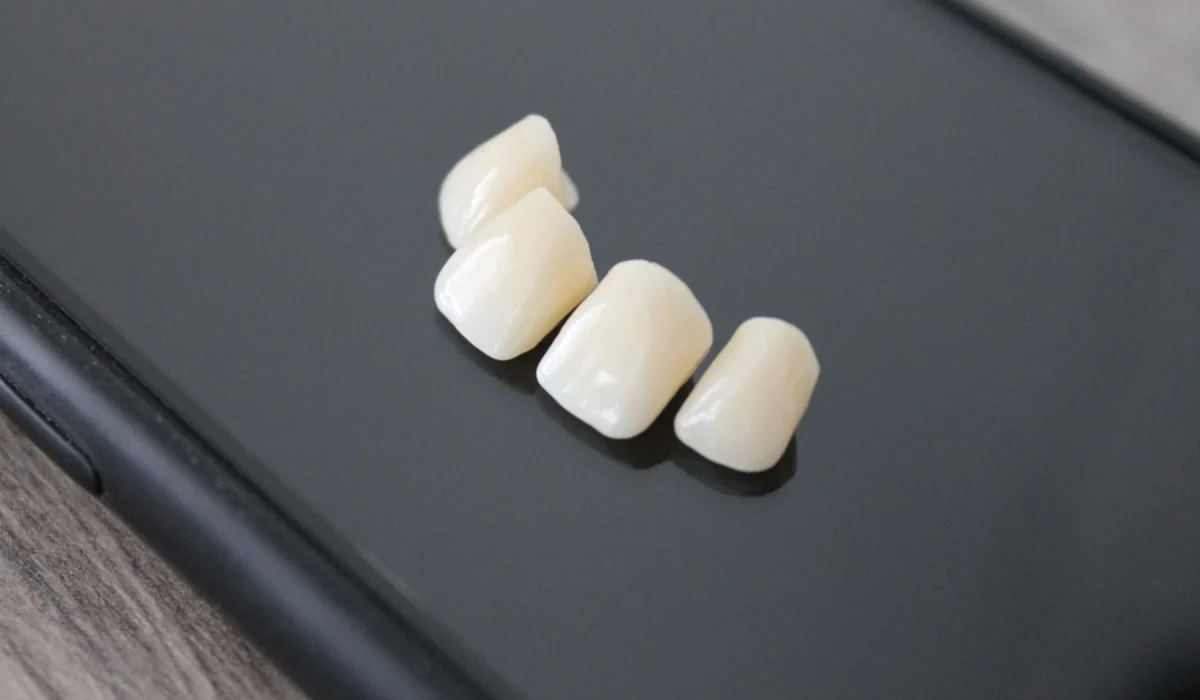 Dental-Ceramic-Crowns