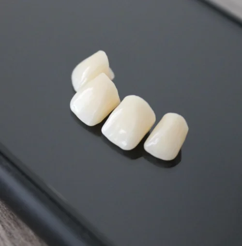 Dental-Ceramic-Crowns
