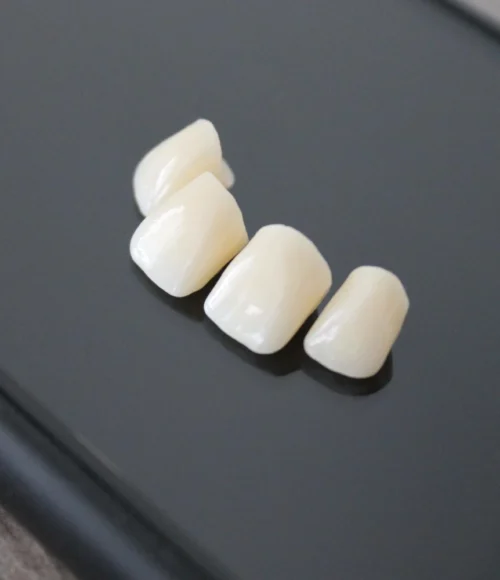 Dental-Ceramic-Crowns