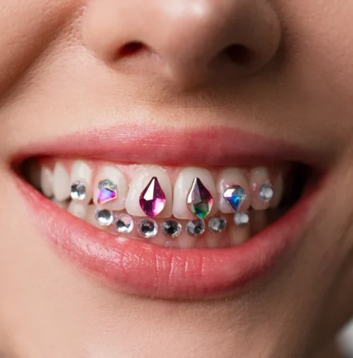 Dental-Strass-01
