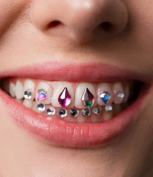 Dental-Strass-01