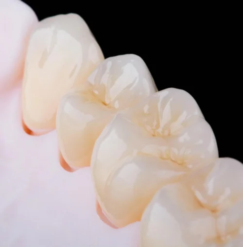 Zirconium Crowns-01