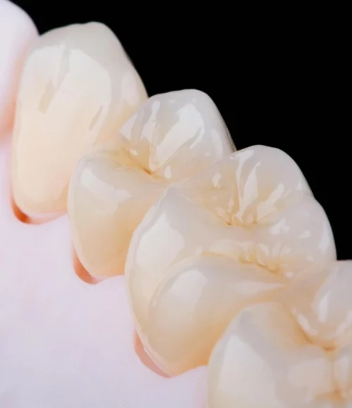Zirconium Crowns-01