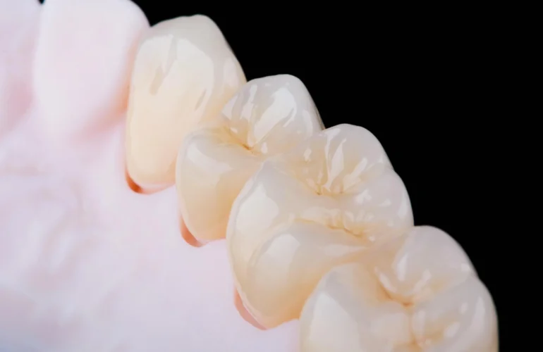 Zirconium Crowns-01